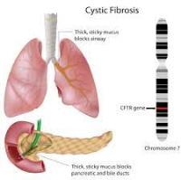 Kistik Fibrosiz Genetiği ve Tedavisinde En Son Gelişmeler