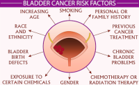 Mesane Kanseri Genetiği